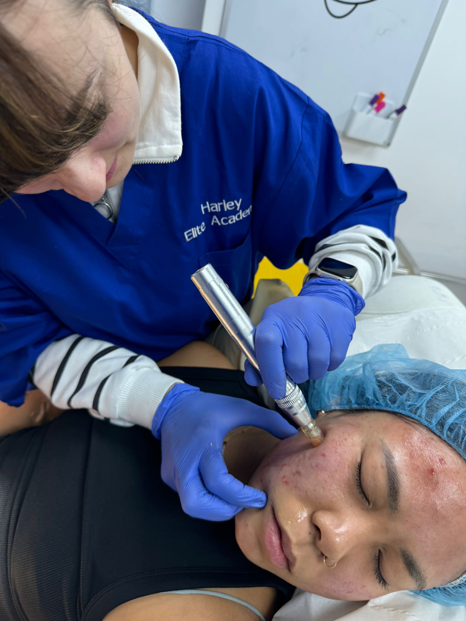 derma pen microneedling course