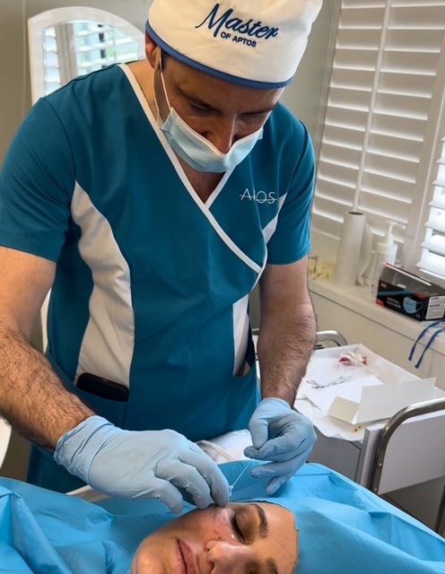 non surgical face neck pdp thread lift