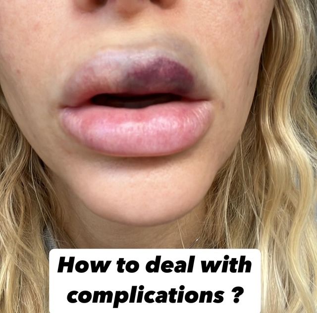 how to deal with aesthetic complications